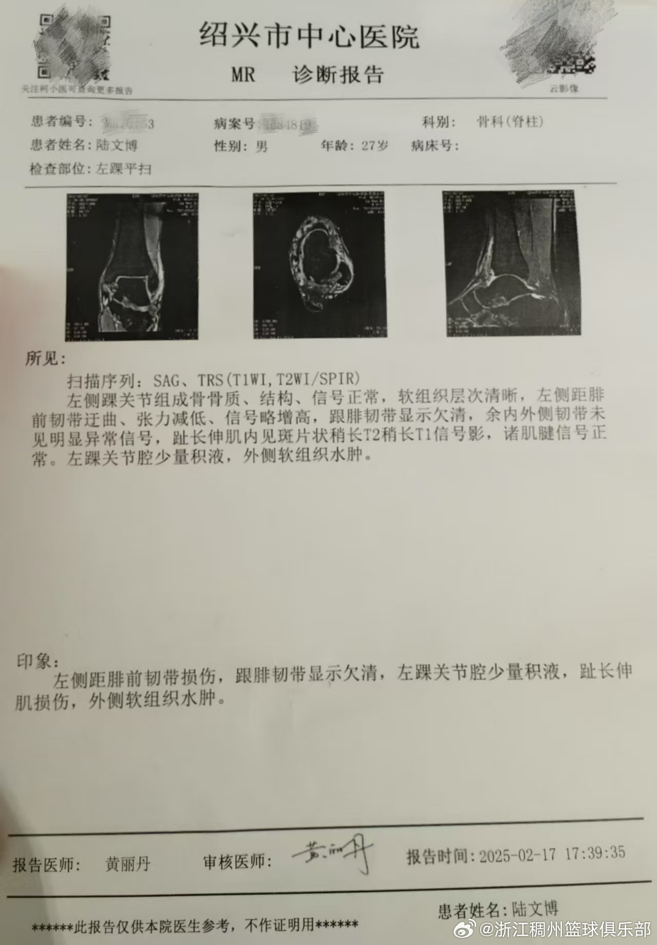 隐藏